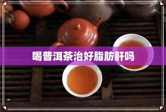 喝普洱茶治好脂肪肝吗 喝普洱茶治好脂肪肝吗