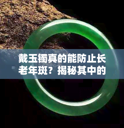 戴玉镯真的能防止长老年斑?揭秘其中的真相与科学原理